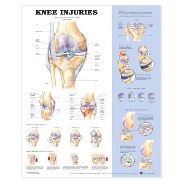 Chart Anatomical Knee Injuries 20x26\